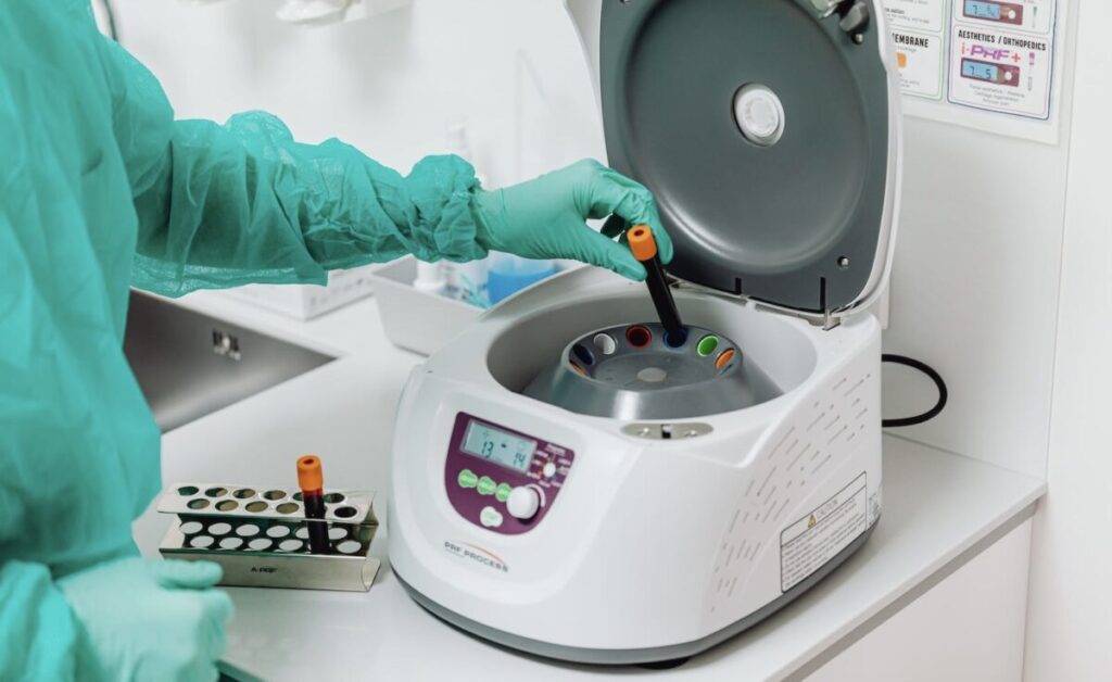 Platelet Rich Plasma