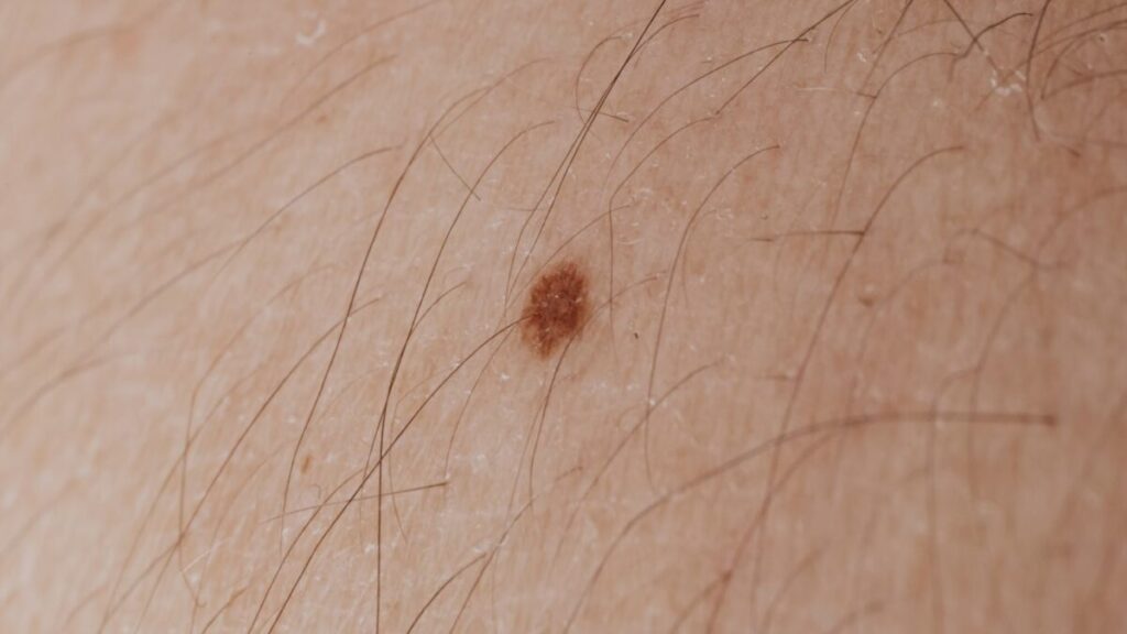 New Hair Growth Molecule Identified