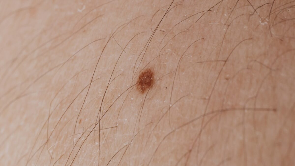 New Hair Growth Molecule Identified