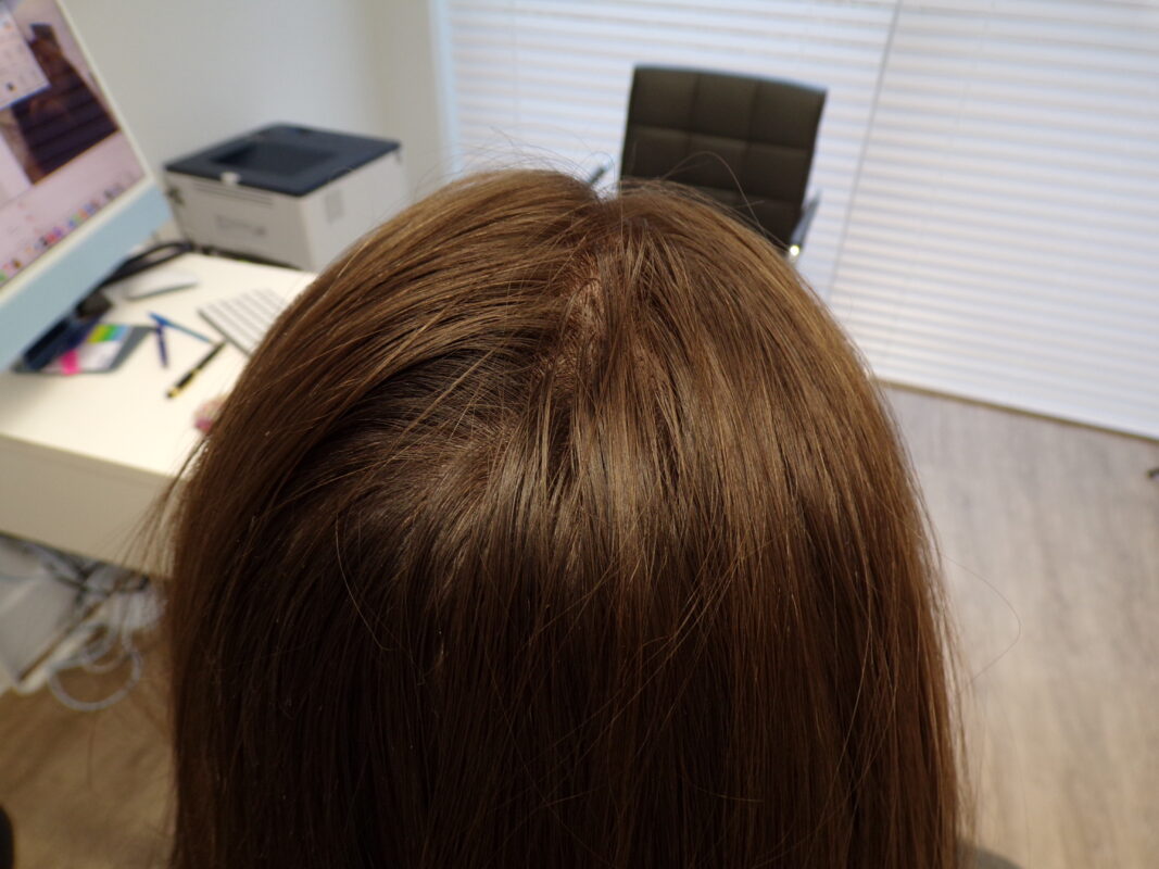 Review after 5 months  