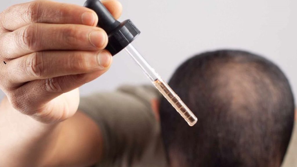Hair thinning solutions for male